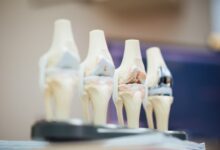 Orthopaedic Treatments in Australia