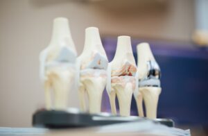 Orthopaedic Treatments in Australia