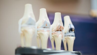 Orthopaedic Treatments in Australia