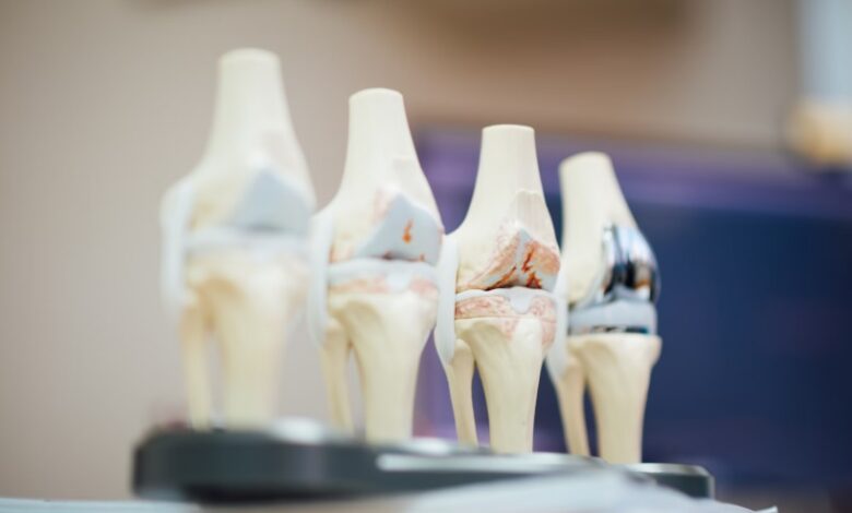 Orthopaedic Treatments in Australia